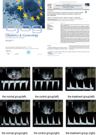 자궁내막 형태 및 초음파